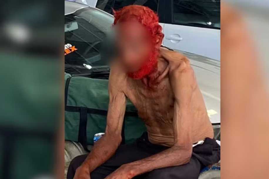 Empresário vira réu por tingir cabelos e barba de idoso em situação de rua