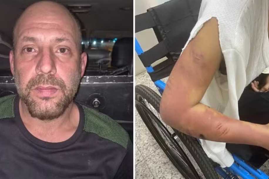 Mulher torturada e mantida em cárcere durante 4 dias já havia sido agredida e acreditou que namorado iria mudar, diz delegado