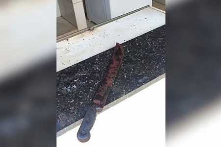 Mulher atacada pelo filho com facão e abandonada na piscina da casa da família tem parte do braço amputado no interior de SP