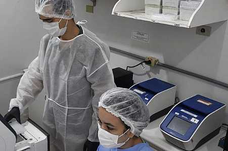Pesquisadores da Fiocruz criam método para detectar hepatite D