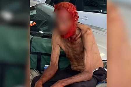 Idoso em situação de rua tem cabelos e barba tingidos de vermelho por empresário em troca de doações
