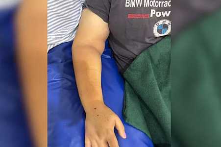 Mulher é picada por cobra jararaca enquanto colhia abóboras em sítio no interior de SP